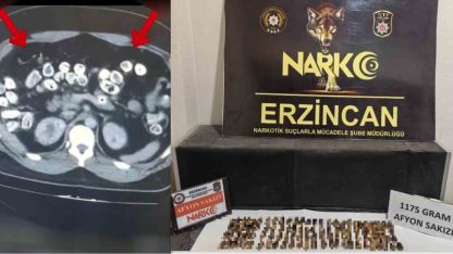 Uyuşturucuyu vücutlarında taşıyan 3 şüpheli yakalandı